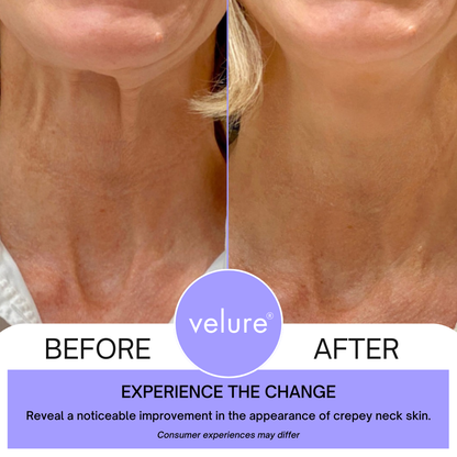 Neck Lift Cream by Velure