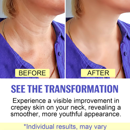 Neck Lift Cream by Velure