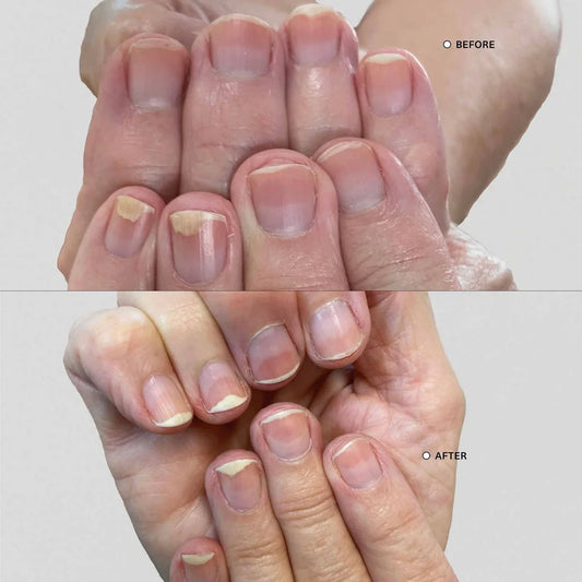 NailBloom™ Repair & Growth Pen