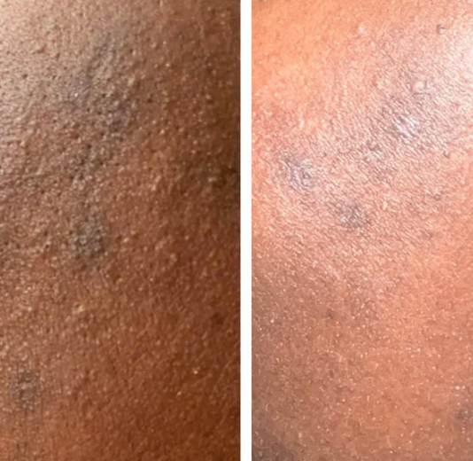 Turmeric Kojic Cleansing Pads (40 Pads)