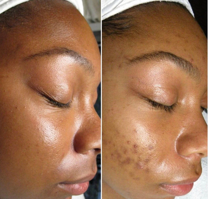 Turmeric Facial Foam Cleanser