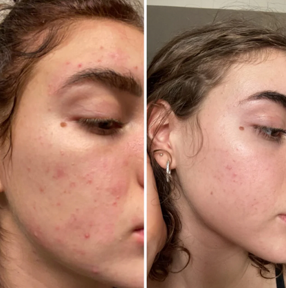 Turmeric Facial Foam Cleanser