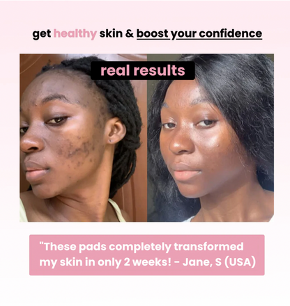 Turmeric Kojic Cleansing Pads (40 Pads)