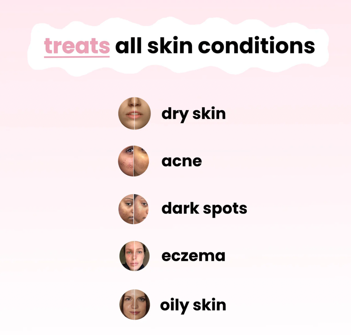 Turmeric Kojic Cleansing Pads (40 Pads)