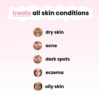 Turmeric Kojic Cleansing Pads (40 Pads)