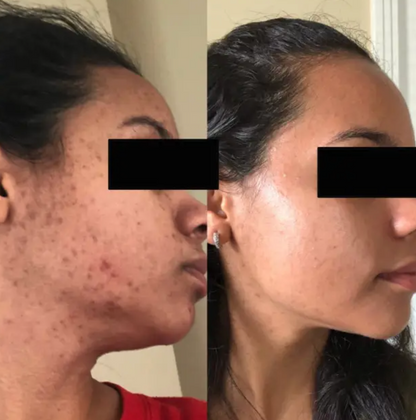 Turmeric Facial Foam Cleanser