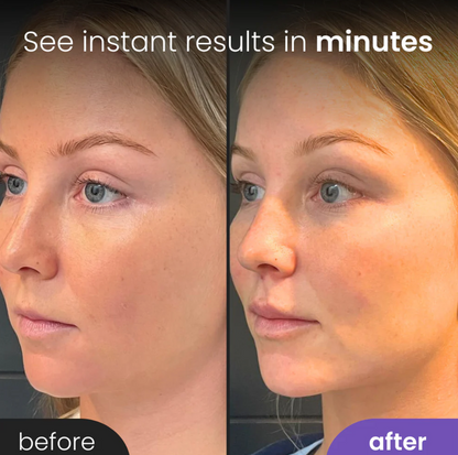 StarLift™ - Germanium Face Roller