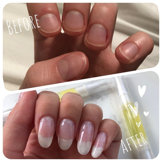 NailBloom™ Repair & Growth Pen