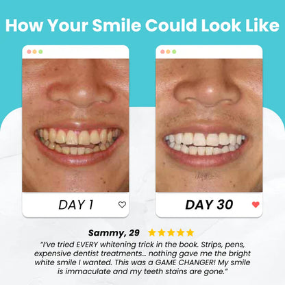 U-Shaped Automatic Toothbrush