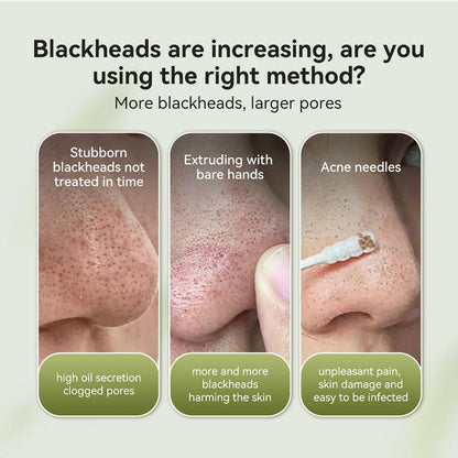 Lanbena - Blackhead remover